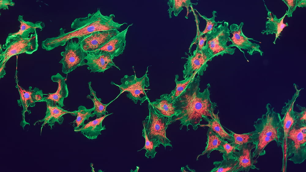 fibroblast cells