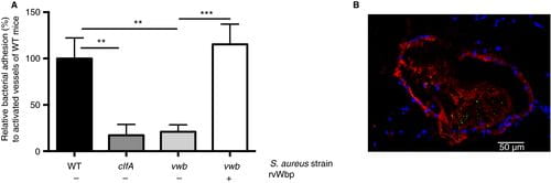 Adhesion of S. aureus to the vessel wall in vivo is mediated by the ternary complex VWF-vWbp-ClfA. (A) In vivo venous mesenteric perfusion model with WT mice. A total of 5 μL of the Ca2+ -ionophore A23187 (10 mm) was applied to the region of the visualized vascular bed to trigger endothelial cell activation and VWF release. A suspension of fluorescent-labeled WT, clfA and vwb strains was injected through the jugular catheter. Where indicated, 20 μg mL−1 rvWbp was added to the bacterial perfusate (n ≥ 14). All results are expressed as mean ± SEM. **P < 0.01, ***P < 0.001. (B) Fluorescence image (× 630) of S. aureus (green) adhering to activated murine vessel wall with immuno-staining for VWF (red) and 4',6-diamidino-2-phenylindole-staining of the cell nucleus (blue). White bar is 50 μm. VWF, von Willebrand factor; vWbp, von Willebrand factor-binding protein; ClfA, Clumping factor A; WT, wild type.