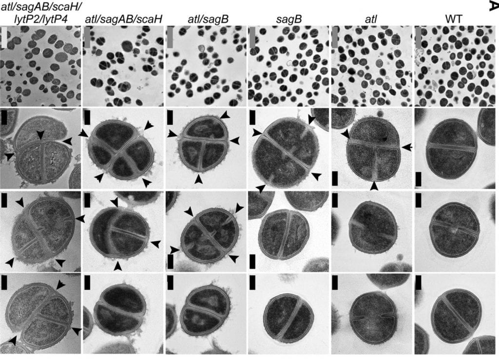 Cell separation defects in S. aureus glucosaminidase mutants. (A) S. aureus Newman strains were fixed, thin sectioned, uranyl acetate stained, and viewed by transmission electron microscopy. Images in the left-most column are representative low-magnification fields of cells for each corresponding frame. The three columns to the right show high-magnification images of representative cell morphologies. Arrowheads identify aberrantly formed septa. Gray scale bars, 2 μm; black scale bars, 0.2 μm.